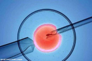 优胚鲜胚移植医学中心